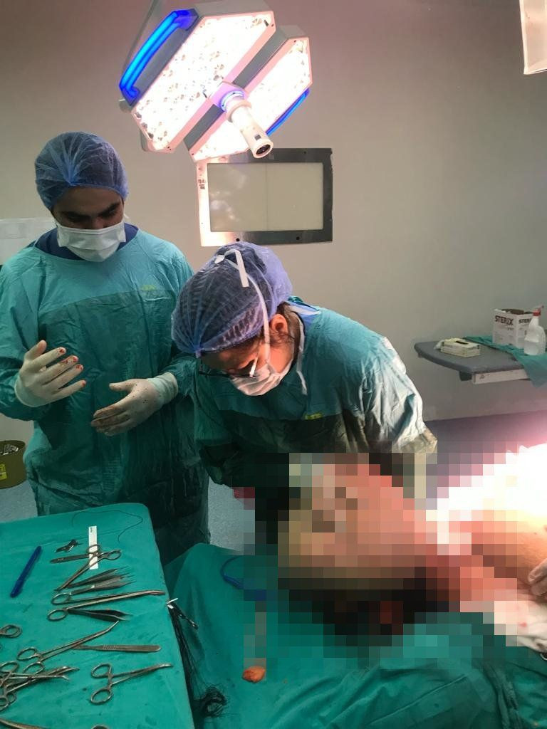 130 kilo kadından 25 kilo yağ dokusu çıkarıldı: Ameliyat 9 saat sürdü - Sayfa 3