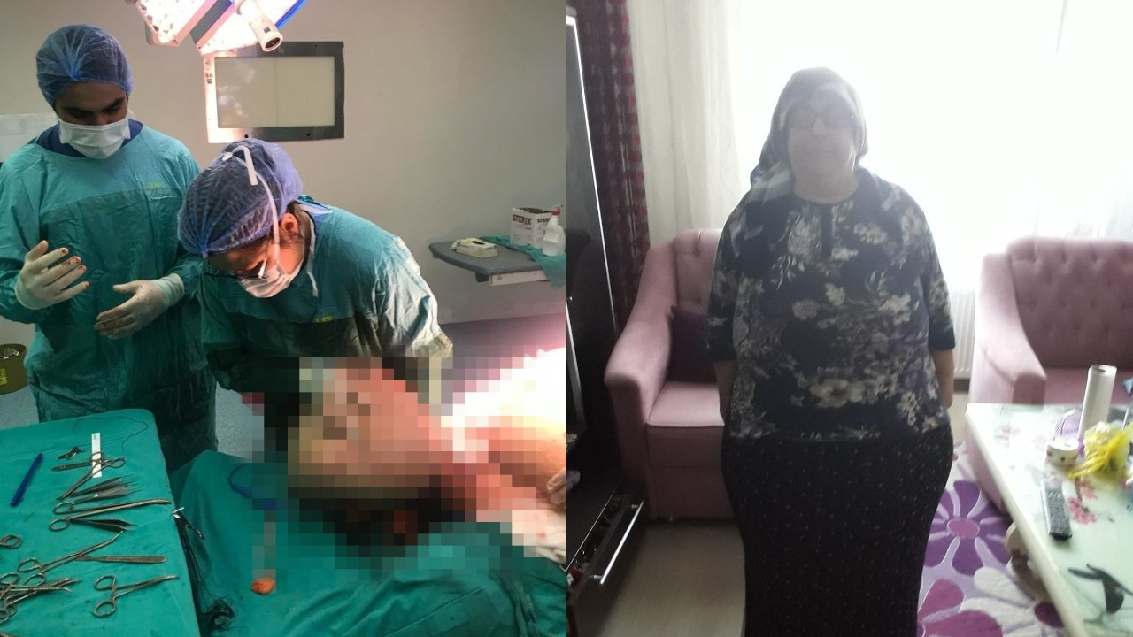 130 kilo kadından 25 kilo yağ dokusu çıkarıldı: Ameliyat 9 saat sürdü