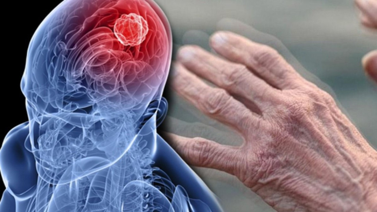 Parkinson hastaları beyin pili tedavisi ile günlük yaşama katılıyor