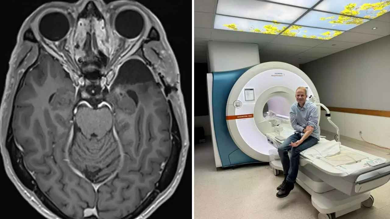 Üzerinde çalıştığı tedavi yöntemiyle beyin kanserini yendi