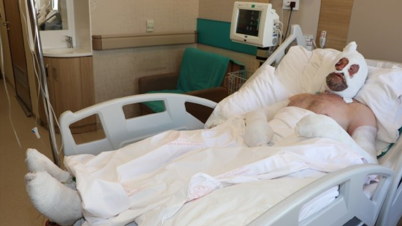 Rize'de soba yakmak isterken yaralanan Topal'ın tedavisi sürüyor