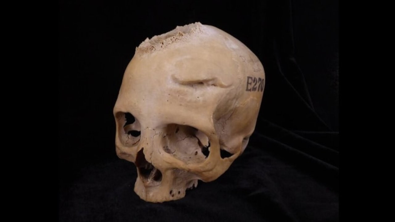 4 bin yıllık kafatası incelendi: Antik Mısır'da kanser tedavisi
