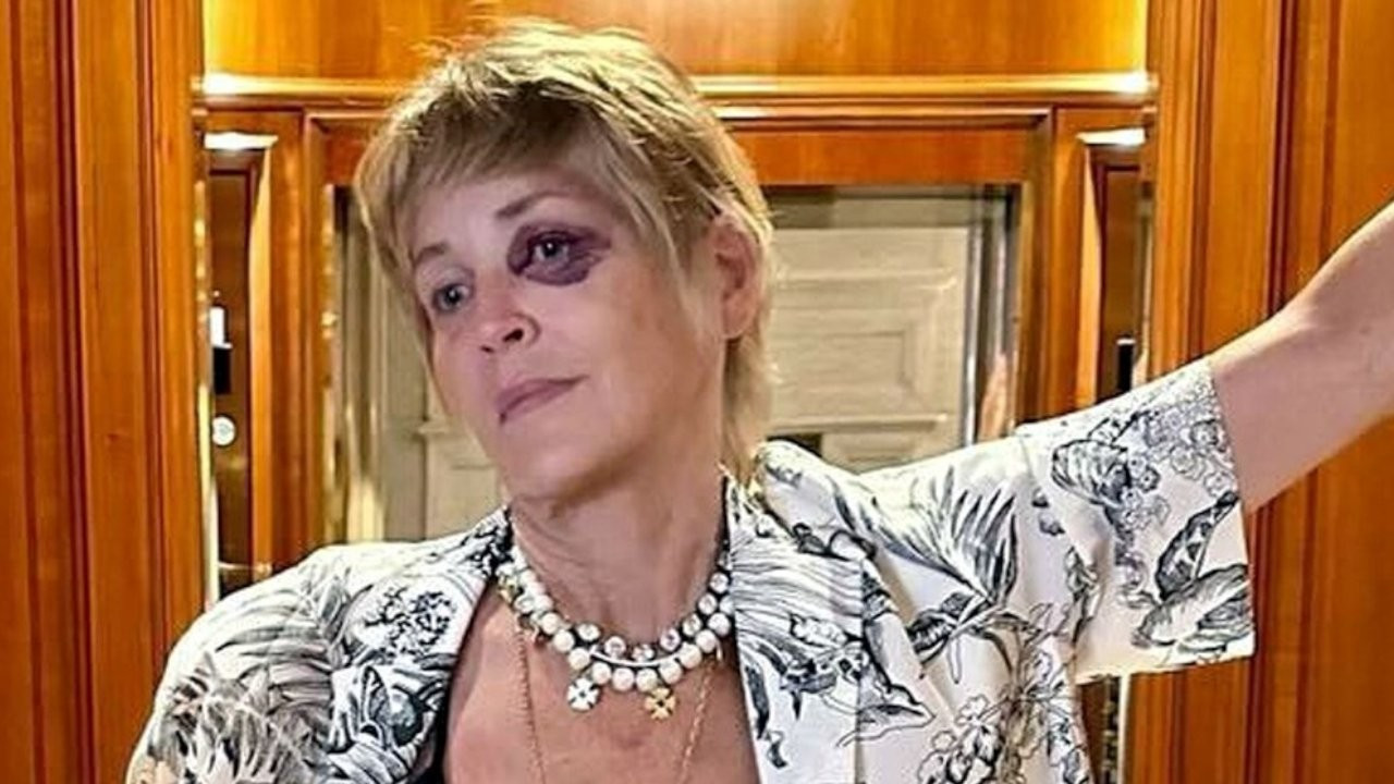 Sharon Stone otelde kaza geçirdi