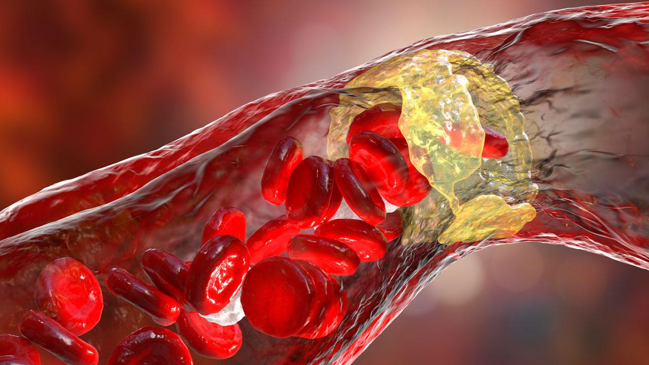 Harvardlı doktorlar açıkladı: Yumurta kolesterol yapar mı?