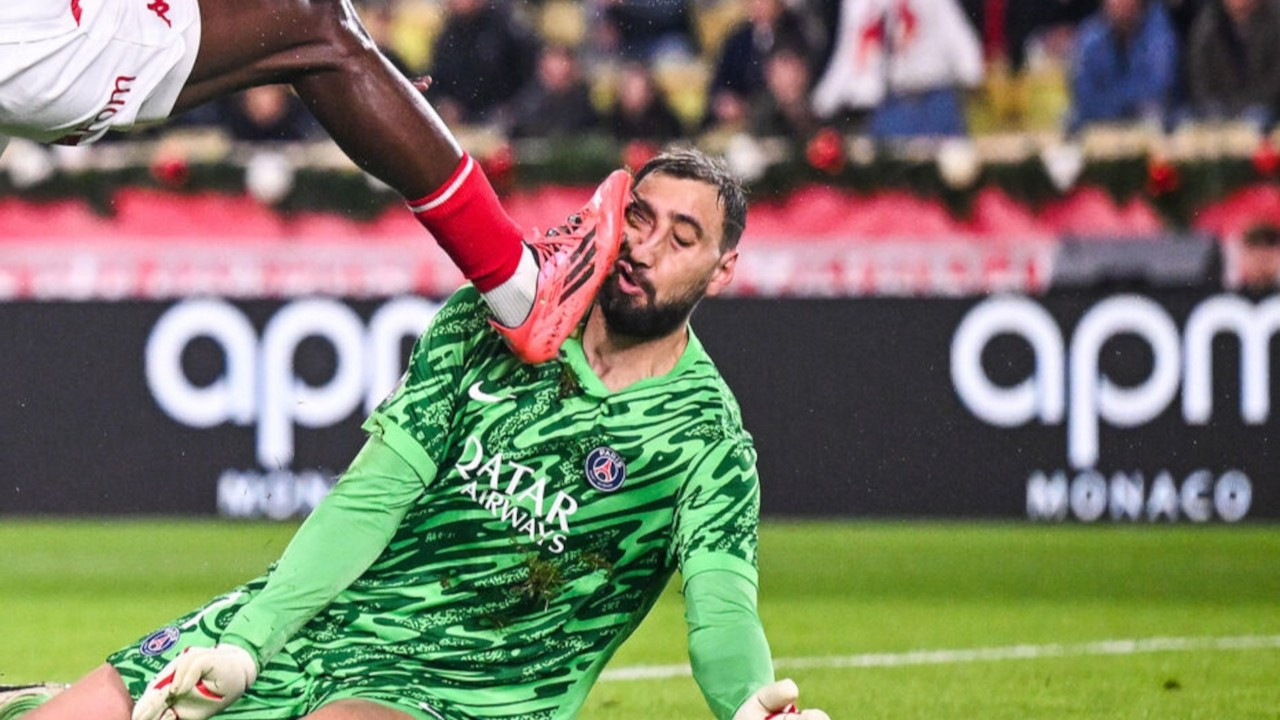 PSG'nin kalecisi Donnarumma'nın yüzü parçalandı